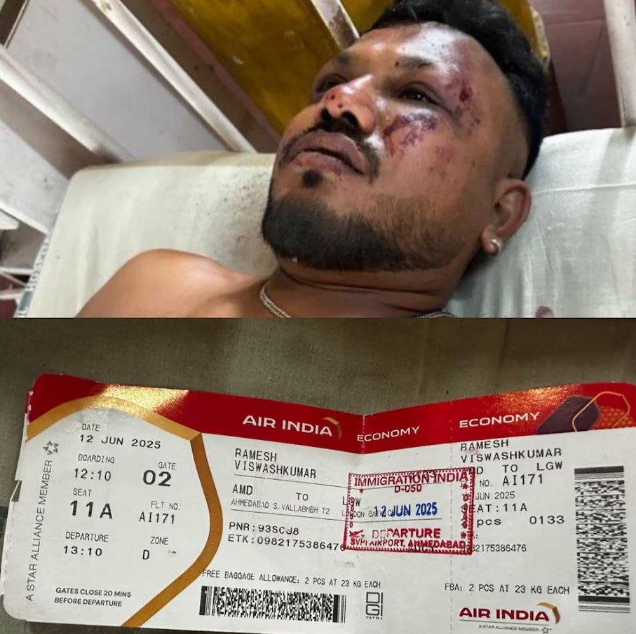 Ramesh Vishwashkumar, único sobreviviente del vuelo AI-171, camina herido entre los escombros.