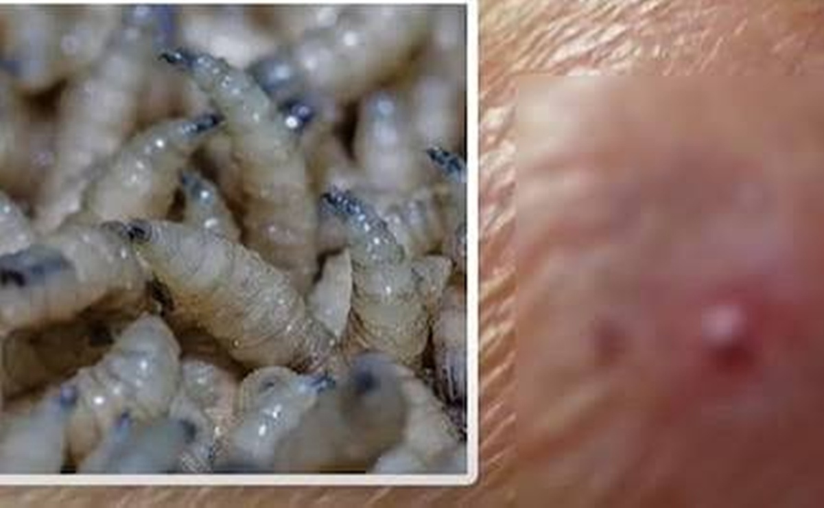 Personal de salud brindó atención oportuna a los pacientes confirmados con el gusano barrenador en Oaxaca.